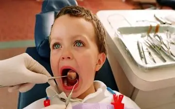 بهترین سن برای مشاوره در زمینه مشکلات فک کودکان