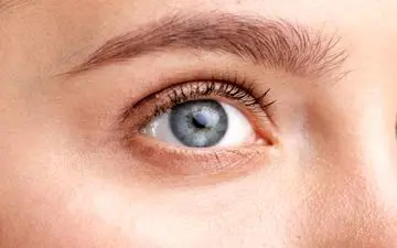 شوره ابرو و مژه | علل ایجاد شوره ابرو و مژه و موثرترین راهکار درمانی