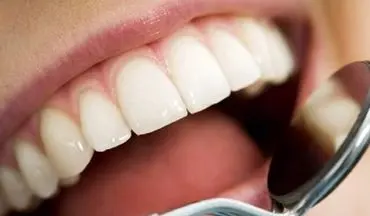 نکات مهم در مراقبت از دهان و دندان دیابتی‌ها