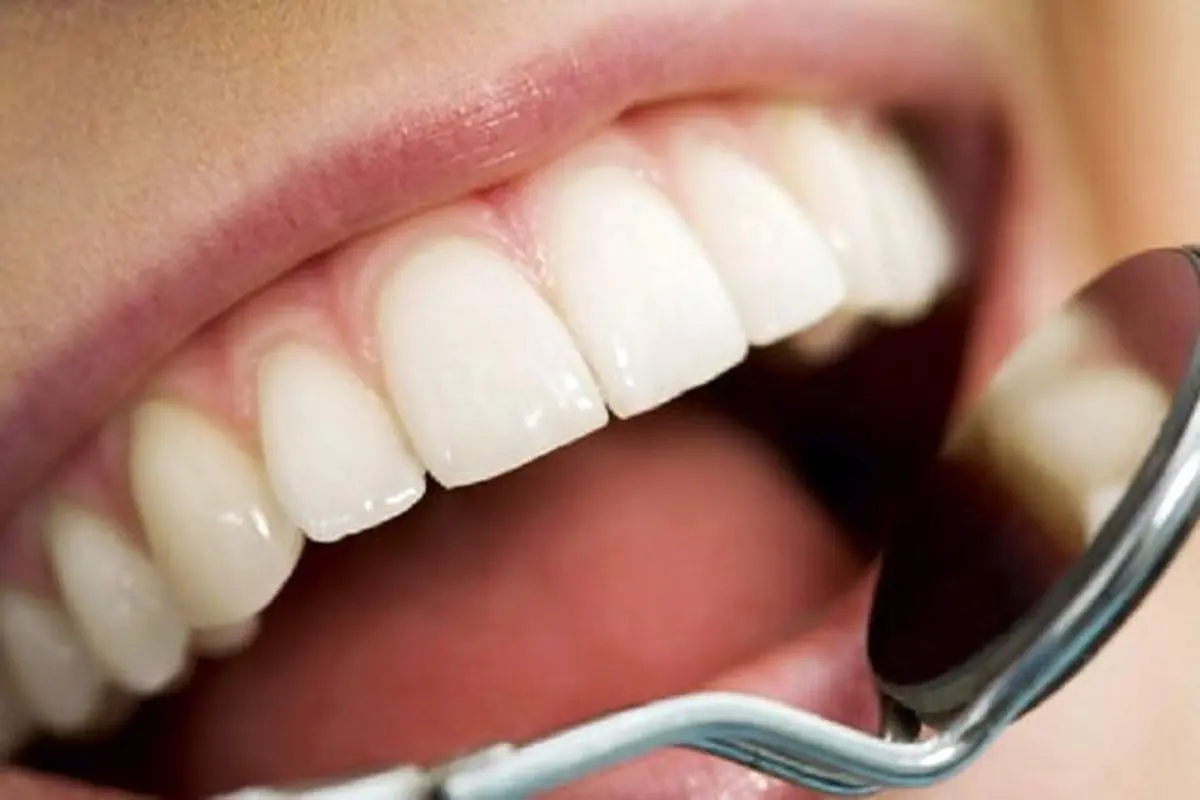 نکات مهم در مراقبت از دهان و دندان دیابتی‌ها