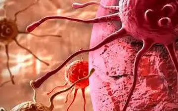 راز پیشگیری و کنترل سرطان!