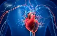 چرا بیماری عروق کرونر در زنان بیشتر است؟