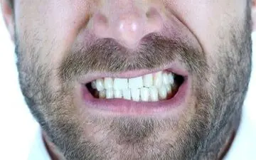 این خوراکی ها دشمن دندان‌های شما هستند

