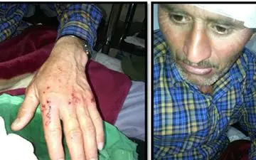 حمله پلنگ وحشی به چوپانی در چناران 