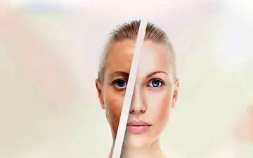 اگر پوستی شفاف می خواهید این کار را بکنید

