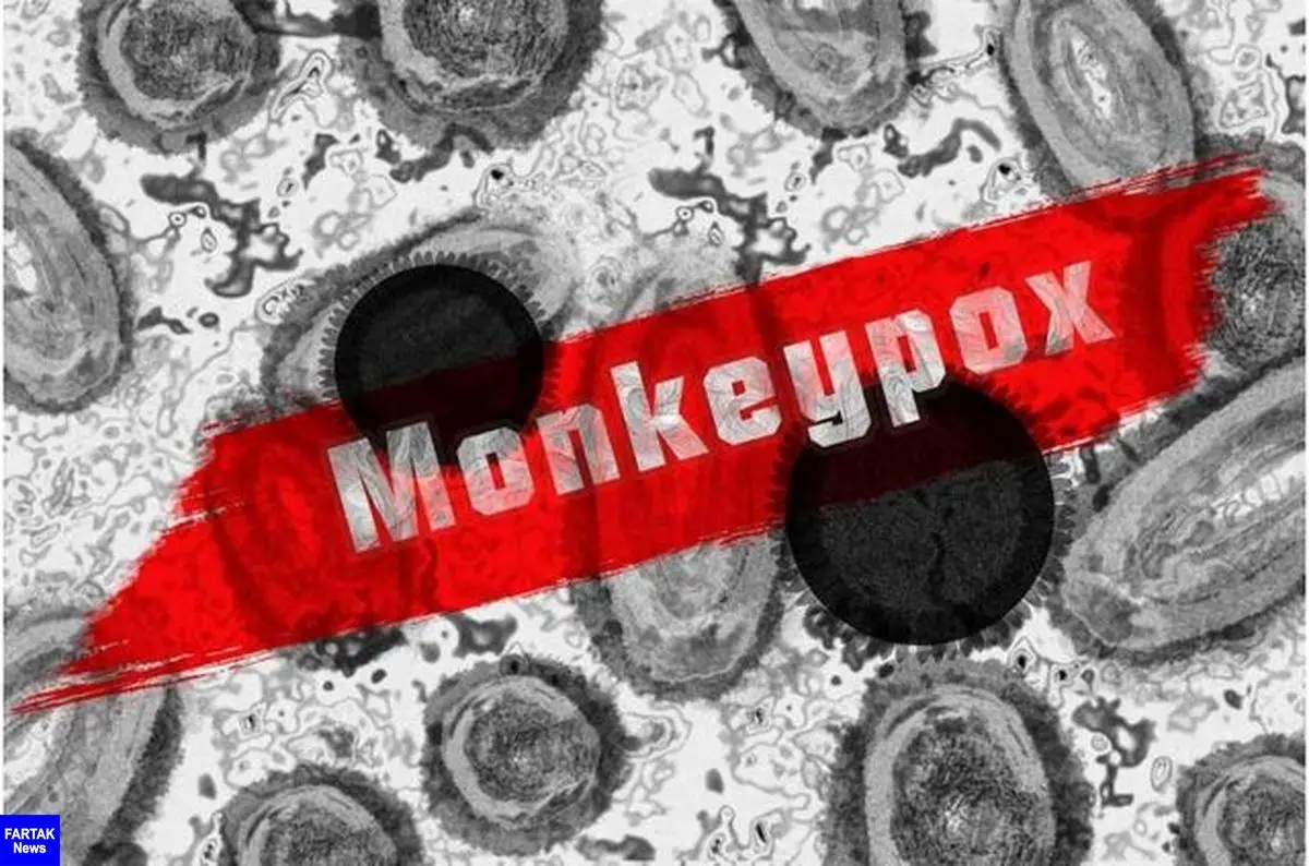 "آبله میمونی" وضعیت اضطراری بهداشت جهانی اعلام شد
