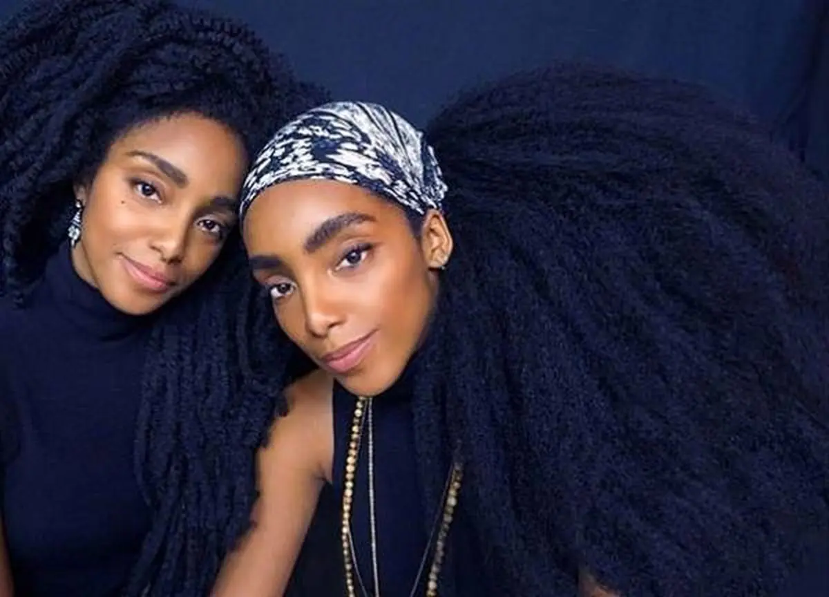 موهای خجالت آور خواهران دو قلو آن‌ها را مشهور کرد
