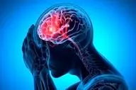 اختلال رایجی که احتمال سکته مغزی را ۷۰ درصد افزایش می‌دهد
