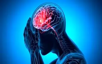 اختلال رایجی که احتمال سکته مغزی را ۷۰ درصد افزایش می‌دهد