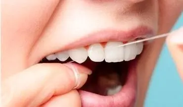 به این دلیل مهم حتما نخ دندان بکشید