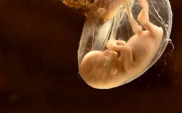 کم تحرکی جنین نشانه چیست؟