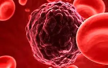 با رعایت این نکات از سرطان سینه در امانید