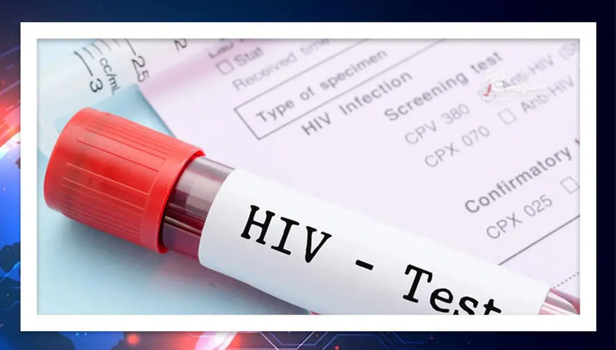 چرا بدن برخی افراد بدون دارو HIV را از بین می برد؟