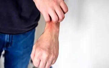 این خارش ها را جدی بگیرید