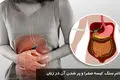 علائم سنگ کیسه صفرا در زنان + درمان خانگی مؤثر