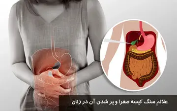 علائم سنگ کیسه صفرا در زنان + درمان خانگی مؤثر