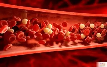 تا قبل از عید نوروز سه سوته کلسترول خون خود را پایین بیاورید 