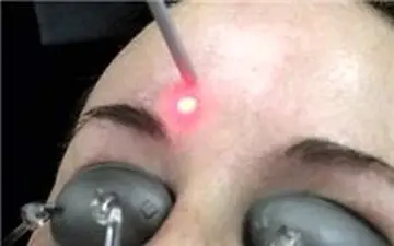  تکنیک های طلایی برای روشن شدن پوست