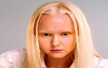 چرا مژه‌‌ها سفید می‌شوند و آیا راه برگشت رنگ هست؟
