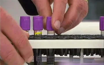 مدیرکل صندوق بازنشستگی کشوری: کمک هزینه آزمایش آنلاین به ۷۵۰هزار تومان افزایش یافت
