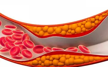 کلسترول خون را با این خوراکی ها پایین بیاورید