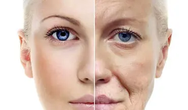 ۸ روش برای جوان ماندن بدون بوتاکس کردن 