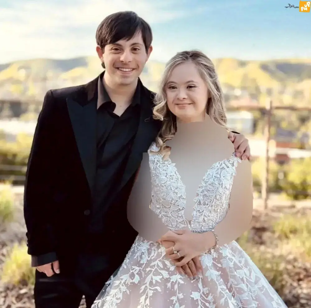 سندروم دوان 