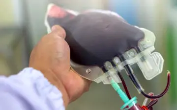 کم خونی خطرناک در اثر کمبود کدام ویتامین در بدن است؟