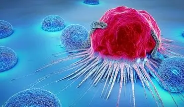 چگونگی پیشگیری از سرطان سینه: راهنمای کامل و عملی