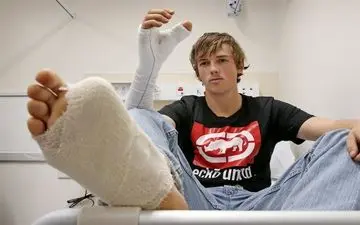 
انگشت شست پا جایگزین انگشت شست دست!+عکس