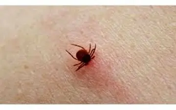 ۱۸ نفر ابتلا و یک مورد فوتی با تب کریمه کنگو 