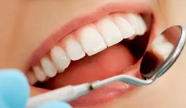 ۵ راه طبیعی برای سفید کردن دندان‌ هایتان