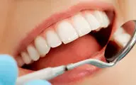 ۵ راه طبیعی برای سفید کردن دندان‌ هایتان