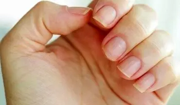 هشدار نسبت به ماده براق‌کننده و محکم‌کننده در کاشت ناخن و لاک ژل