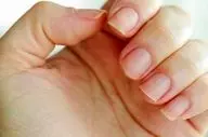 هشدار نسبت به ماده براق‌کننده و محکم‌کننده در کاشت ناخن و لاک ژل