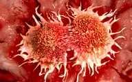 تشخیص رابطه معکوس بین تب و سرطان