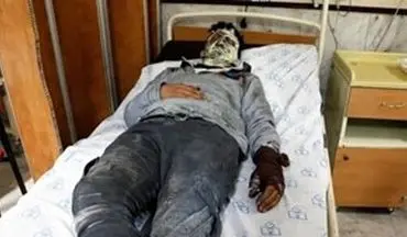 حادثه ماقبل چهارشنبه سوری در قزوین رقم خورد/ مصدومیت ۲ نفر در انفجار مواد محترقه