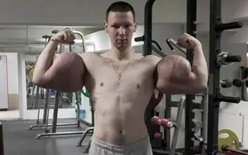 پایان دردناک شهرت با سینتول؛ «ملوان‌زبل روسی» در آستانه از دست دادن دست‌هایش