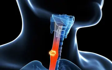 برای کاهش اسید معده چه بخوریم؟