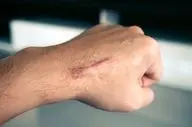 هشدار متخصص: کلوئید را جدی بگیرید
