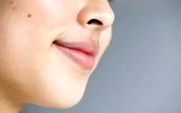 از بین بردن موهای زائد پشت لب با درمان خانگی