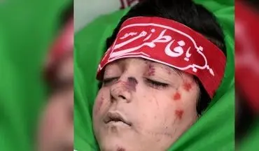 این پسر کوچولوی ایرانی هم شهید شد ! + عکس سهیل کطولی 11 ساله !
