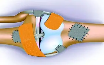 علل اصلی کاهش کاهش تراکم استخوان