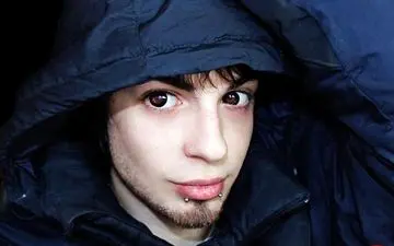 پسر جوان پس از چند عمل زیبایی شبیه اجنه‌ شد + تصاویر