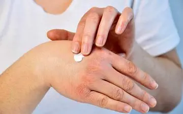  بررسی نقش طب سنتی در درمان‌ بیماری‌‌های پوستی
