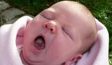 برفک دهان نوزاد چیست و تا چه حد خطرناک است؟