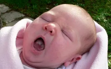 برفک دهان نوزاد چیست و تا چه حد خطرناک است؟