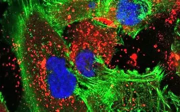 سرطان مغز و درمانی جدید