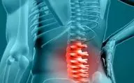 این عوامل باعث ابتلای شما به دیسک کمر می‌شوند