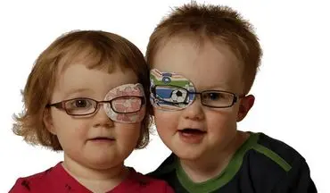 خبری خوب برای کودکان مبتلا به تنبلی چشم